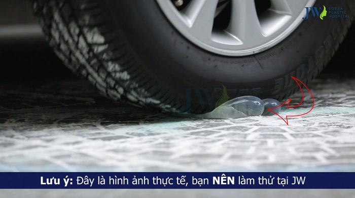 nang-nguc-noi-soi-4